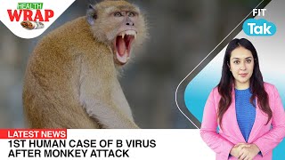 Hong Kong's first human case of B virus, Nestle India controversy | Health Wrap | Latest World News