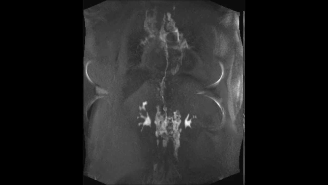 Watch video titled DCMRL study showing contrast on YouTube