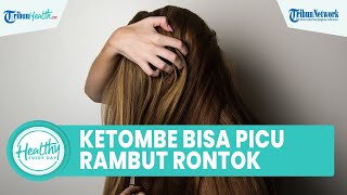Mitos atau Fakta Ketombe Dapat Picu Rambut Rontok?, Begini Tips Menjaga Kesehatan Rambut