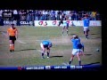 Worst Rugby Injury Ever Grey College Vs Grey High NOT FOR SENSITIVE VIEWERS