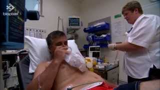 Stinger season opens in Australia