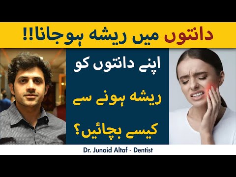 Danton Mein Resha Hojana |Dental Abscess | Pus in Teeth  | دانتوں میں پیپ کا بننا