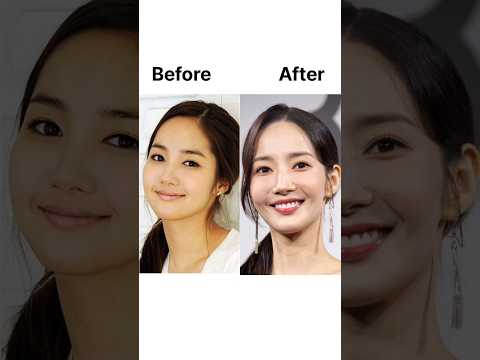 K-celebs ruined face with plastic surgery 📸✨#goviral #kpop #shorts #parkminyoung #youtube #NINNIEWON