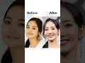 K Celebs Ruined Face With Plastic Surgery Goviral Kpop Shorts Parkminyoung Youtube NINNIEWON