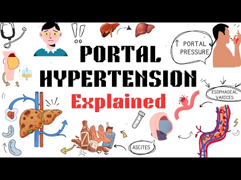 Portal Hypertension Explained Clearly in 4 Minutes | High-Yield Concept 