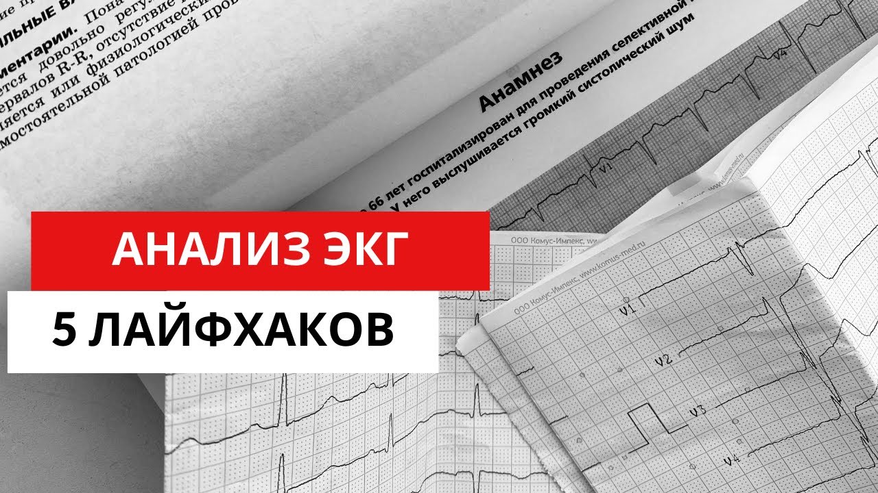 5 особенностей (лайфхаков) при АНАЛИЗЕ ЭКГ.