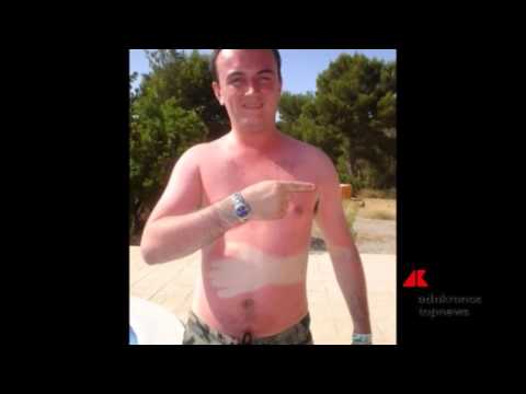 Isme decolorazione DOmsk di crema Il pigmentary nota che fare