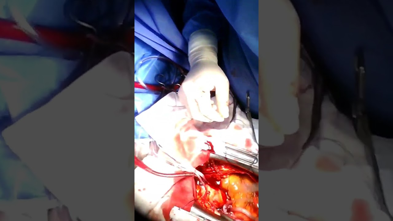 João Victor Ventura De Oliveira-4