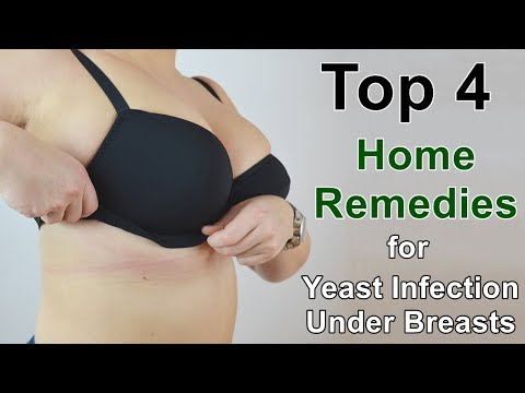 Home Remedies for Yeast Infection Under Breasts - These Work Well All the Time Video