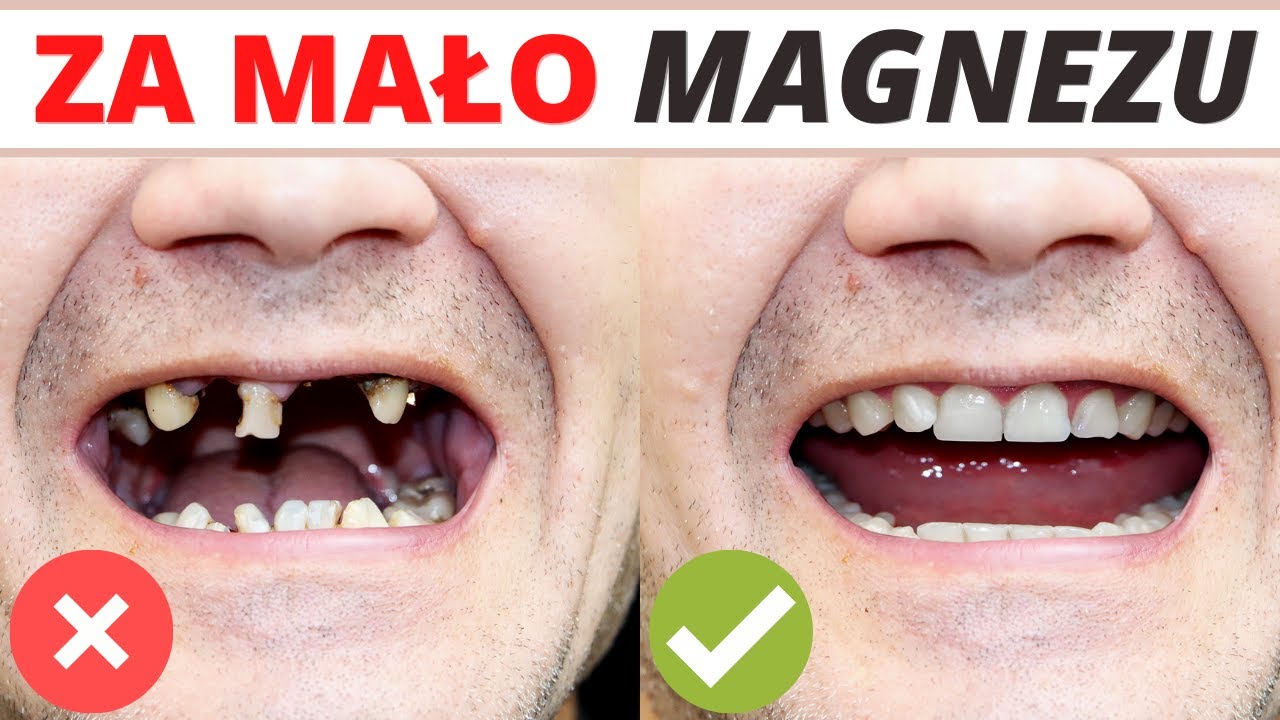 10 ukrytych zastosowań MAGNEZU. Zęby, wątroba, ból, wirusy...