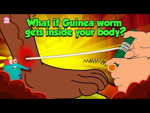 Deadliest Parasite | What if Guinea Worm Gets Inside Your Body? | Dracunculiasis | Dr Binocs Show