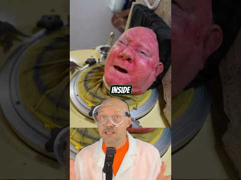 The man with the iron lung