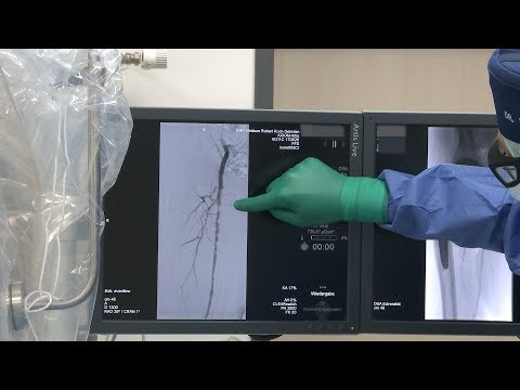 Therapieoptionen bei Schaufensterkrankheit