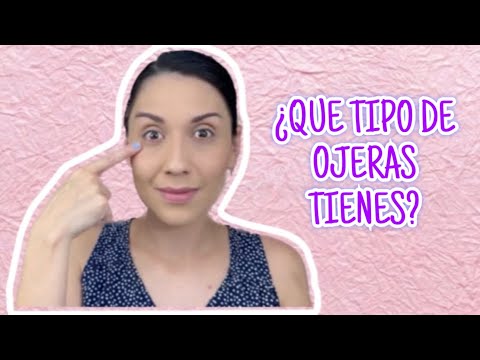 TIPOS DE OJERAS Y COMO TRATARLAS-Bren EsAv