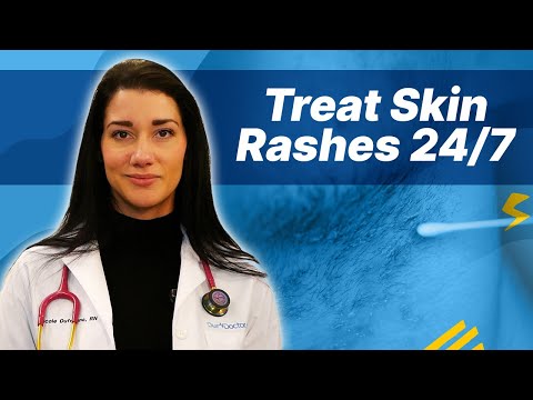 Treat Skin Rashes Fast! 24/7 Online Diagnosis & Relief | OurDoctor.com