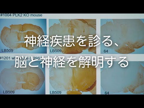 【山形大学】研究紹介2021：太田康之（脳神経内科学/医学部担当）