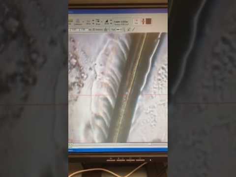 download lagu mp3 mp4 Trichanalytics, download lagu Trichanalytics gratis, unduh video klip Download Trichanalytics Mp3 dan Mp4 Full Gratis