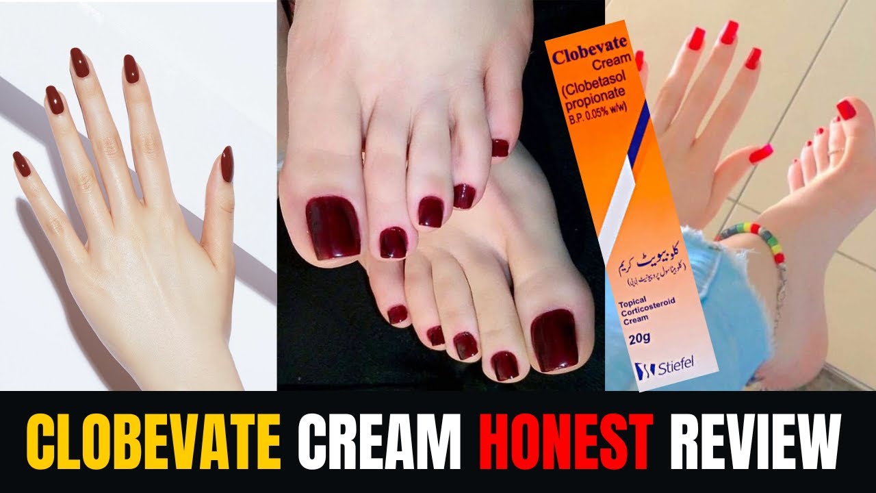 Clobevate Cream For Hand and Foot Whitening| Hath paon Gora krne Ka Formula|Clobevate Formula Cream