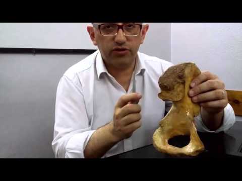 02    Borde y Angulos del hueso Coxal