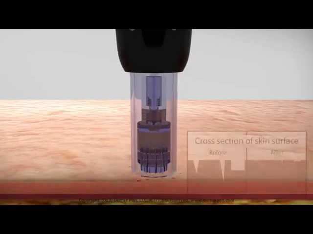 Youtube - Derma Center by Kate Poensgen