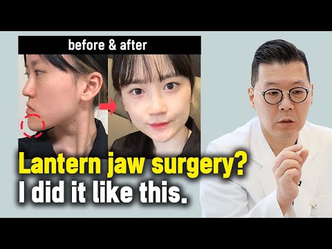 [EN/JP] Korean Double Jaw Surgery Case Review (Lantern Jaw)