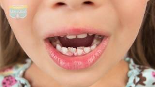 ¿Por qué no se la han caído los dientes a mi hijo