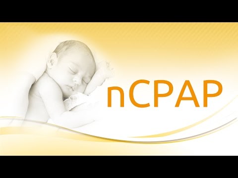 medinCNO ventilation modes: nCPAP with leackage compensation