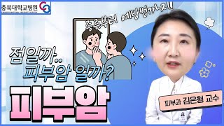 The difference between a mole and skin cancer 썸네일