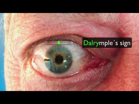 Sono2Learn: online Grundkurs Schilddrüse und Nebenschilddrüsen