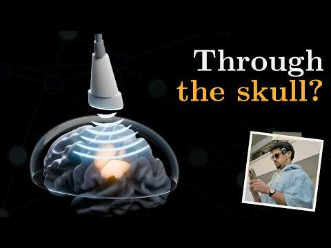 Is Ultrasound the Next Neurotech Frontier? A Deep Dive Into ...
