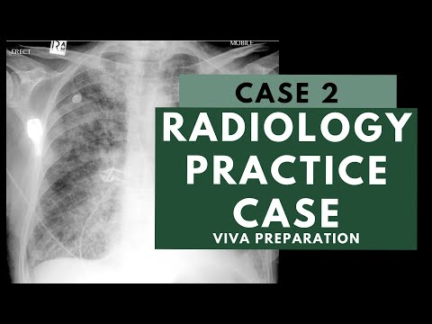Radiology Viva Practice Case: 2 - FRCR 2B preparation