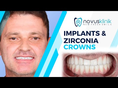 Logo of Analyzing the Novusklinik Experience in Istanbul, Turkey – Affordable Dental Implants Abroad