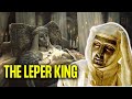 What Really Happened To The Leper King - Baldwin IV of Jerusalem