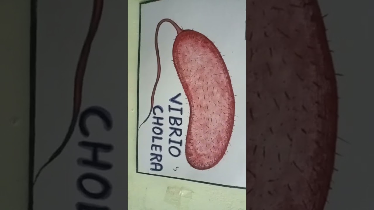 VIBRIO CHOLERA FIGURE