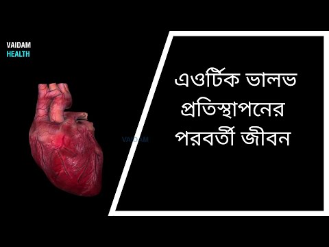এওর্টিক ভালভ প্রতিস্থাপনের পরবর্তী জীবন