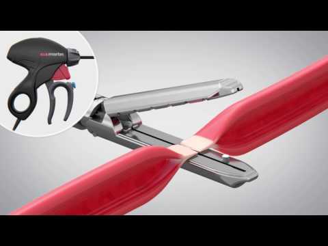 marSeal 5 plus – Features and functions