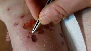 SCAB Picking XXX huh.,.,