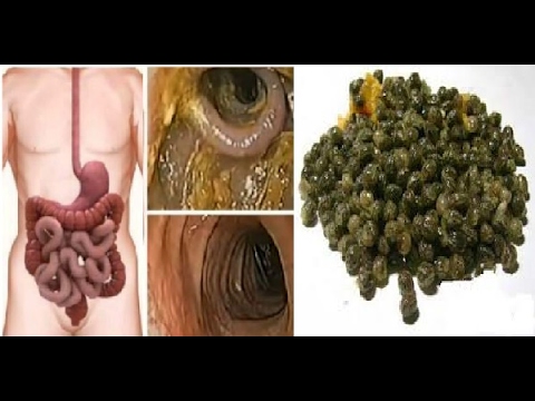 Paraziták a marihuánán, Kiegészítők marihuána méregtelenítés - vivabalaton.hu
