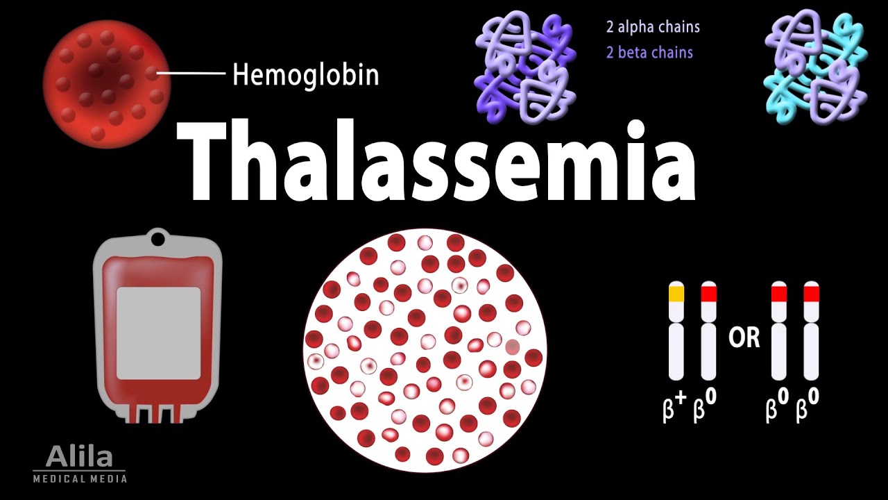Thalassemia: Alpha & Beta-Thalassemias, Genetics, Pathophysiology, Diagnosis & Treatment, Animation