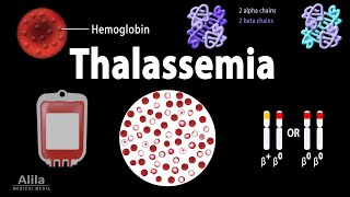 Thalassemia: Alpha & Beta-Thalassemias, Genetics, Pathophysiology, Diagnosis & Treatment, Animation
