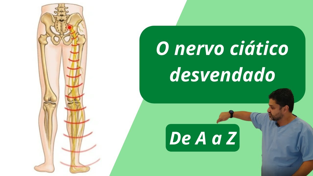 😎 O nervo ciático desvendado de A a Z.