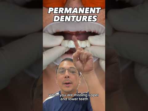 Implant Retained Denture EXPLAINED | In Office to Hands On Dental Training #shorts
