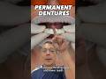 Implant Retained Denture EXPLAINED | In Office to Hands On Dental Training #shorts