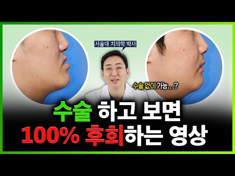 양악수술 해? 말아? 이 영상으로 종결합니다. [서울대 구강악안면외과 전문의]