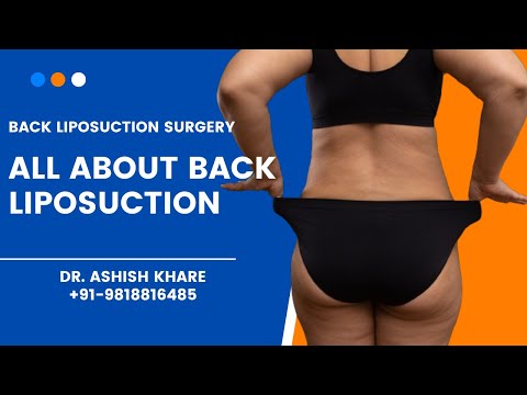Cost of Liposuction Belly Fat Removal Delhi NCR