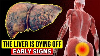 14 early signs that your LIVER IS DYING. People with liver problems don