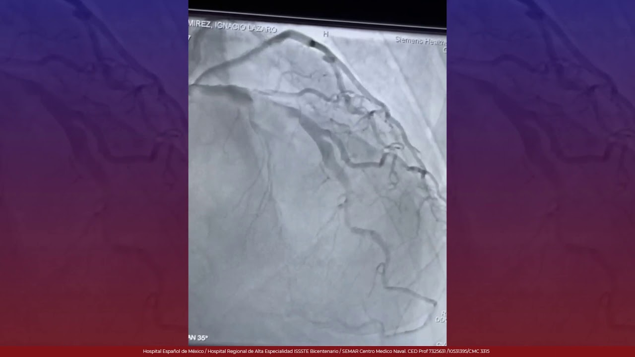 Marcelo Utrera Lagunas-100