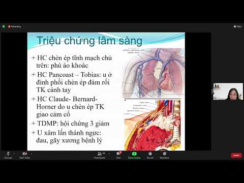 Lý thuyết: Ung thư phổi (p1)