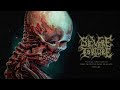 Severe Torture - Torn from the Jaws of Death (Full Album) Video