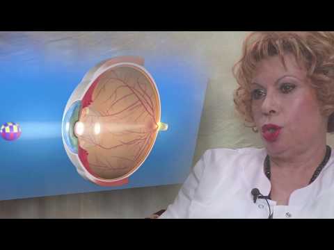 ELIKSIR : Katarakta, simptomi i lečenje (Prilog 4)